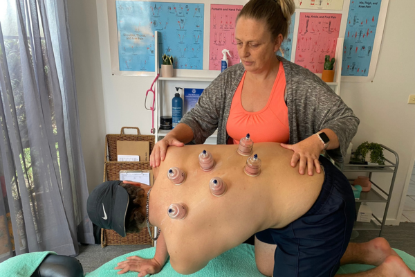 Myofascial cupping for the treatment of chronic pain